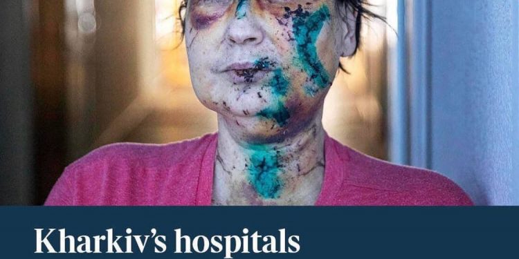 Британская The Times показала лицо войны в Украине