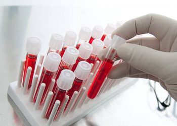 Украина передает Германии образцы крови «славянского этноса»