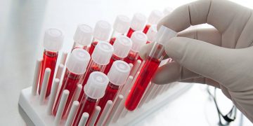 Украина передает Германии образцы крови «славянского этноса»