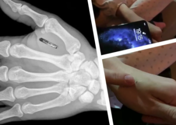 Как жить с микрочипом в руке?