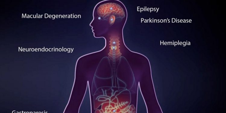 Импланты, которые смогут работать десятки лет