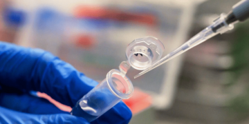 Эпидемия оспы обезьян в Украине