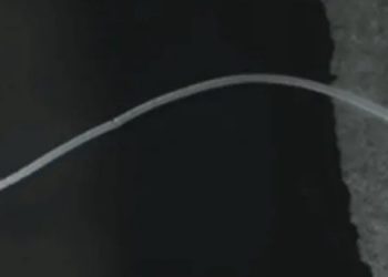 Самая большая в мире бактерия