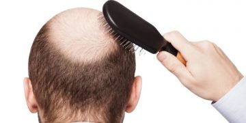 Как вернуть пышную шевелюру