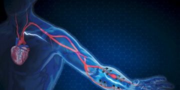 Ученые создали датчик, отслеживающий давление