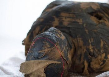 У беременной мумии обнаружили рак