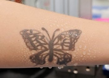 Нанотатуировка, сообщающуя о проблемах со здоровьем