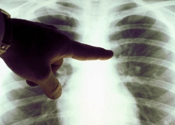 Автомобильные выхлопы провоцируют  рак легких