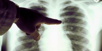 Автомобильные выхлопы провоцируют рак легких