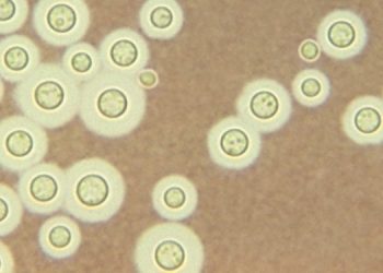 Найден опасный грибок, меняющий форму