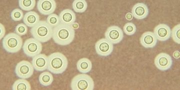 Найден опасный грибок, меняющий форму