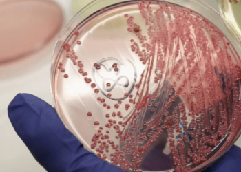 В Украине зафиксировали случай сибирской язвы