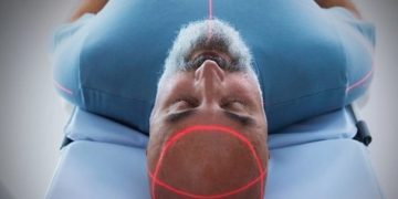 Фактор №1 появление болезни Альцгеймера