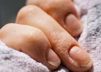 Какие заболевания можно диагностировать по ногтям